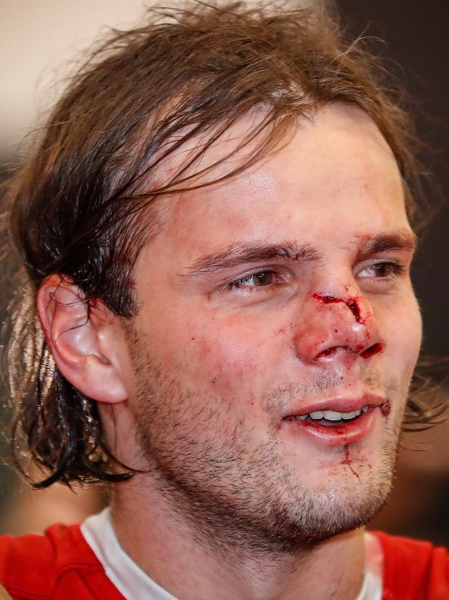 Hunter Clark’s nose was bent out of shape. (Photo by Michael Willson/AFL Photos via Getty Images)