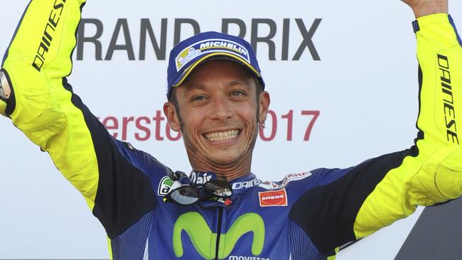 Valentino Rossi’s condition updated after breaking leg in motocross crash.