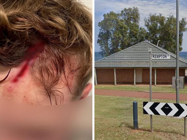 Backpacker bashed by gang in toilet block