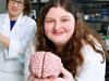 Groundbreaking SA study puts head injuries under microscope