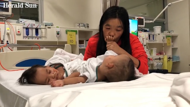 Mum says goodbye  before twins surgery