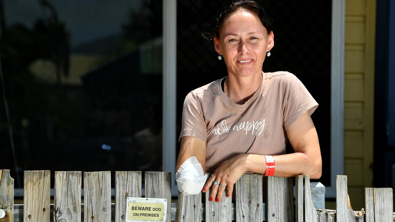 Garbutt resident Annmarie Walters lost her arm in a gruesome dog attack. Picture: Evan Morgan