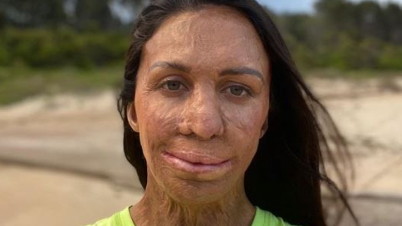 Turia Pitt has revealed her secrets to happiness. Picture: Instagram.