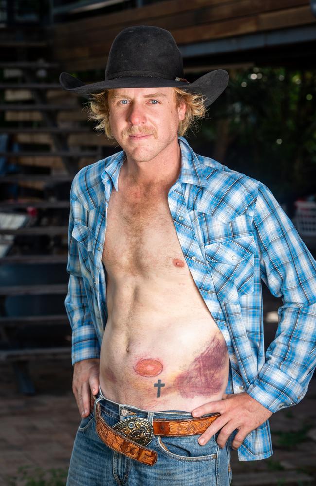 Brodie Frizzell was injured by a bull at Bloomsbury near Mackay on the weekend, when a bull pinned him against the chute.