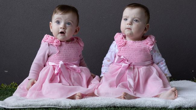 Identical twins, Evelyn (white sleeves and Genevieve (pink sleeves) had twin to twin transfusion syndrome and underwent fetal laser surgery while still in the womb. They were then born prematurely at 23 weeks and one day. Photography David Kelly