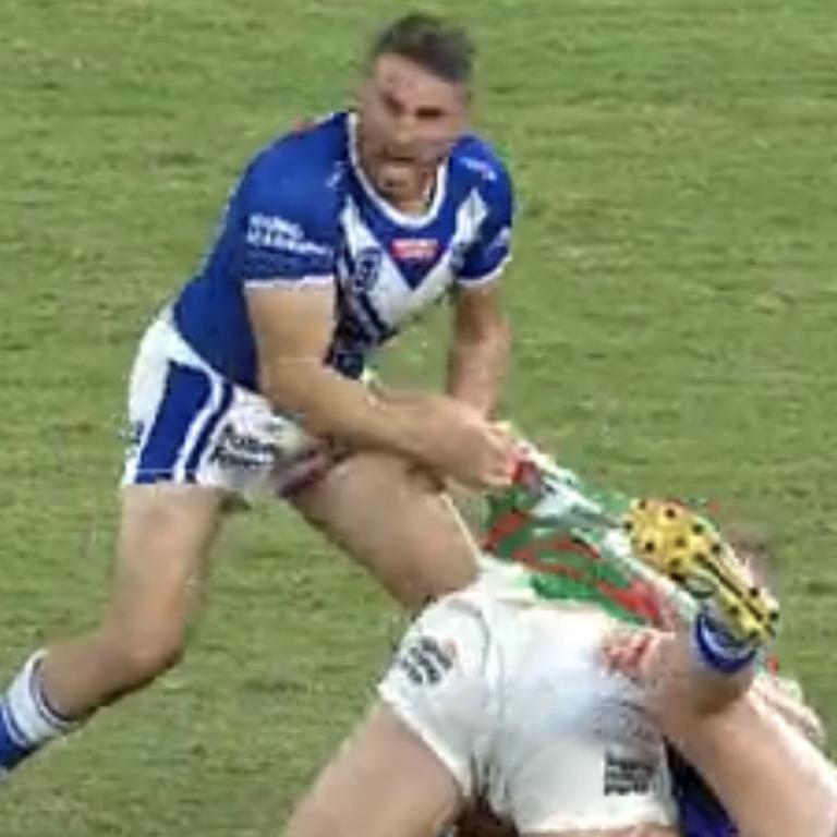 Reynolds winces in pain.