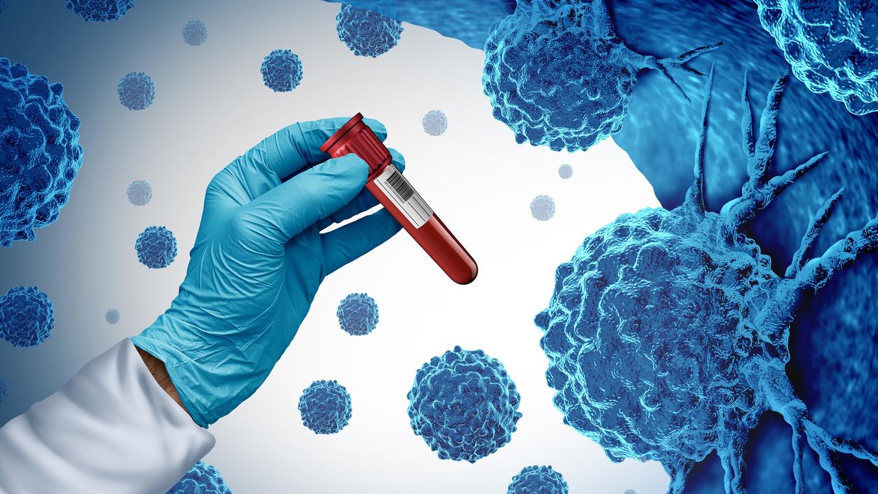 Cancer blunder hits 500 patients of Sydney hospital