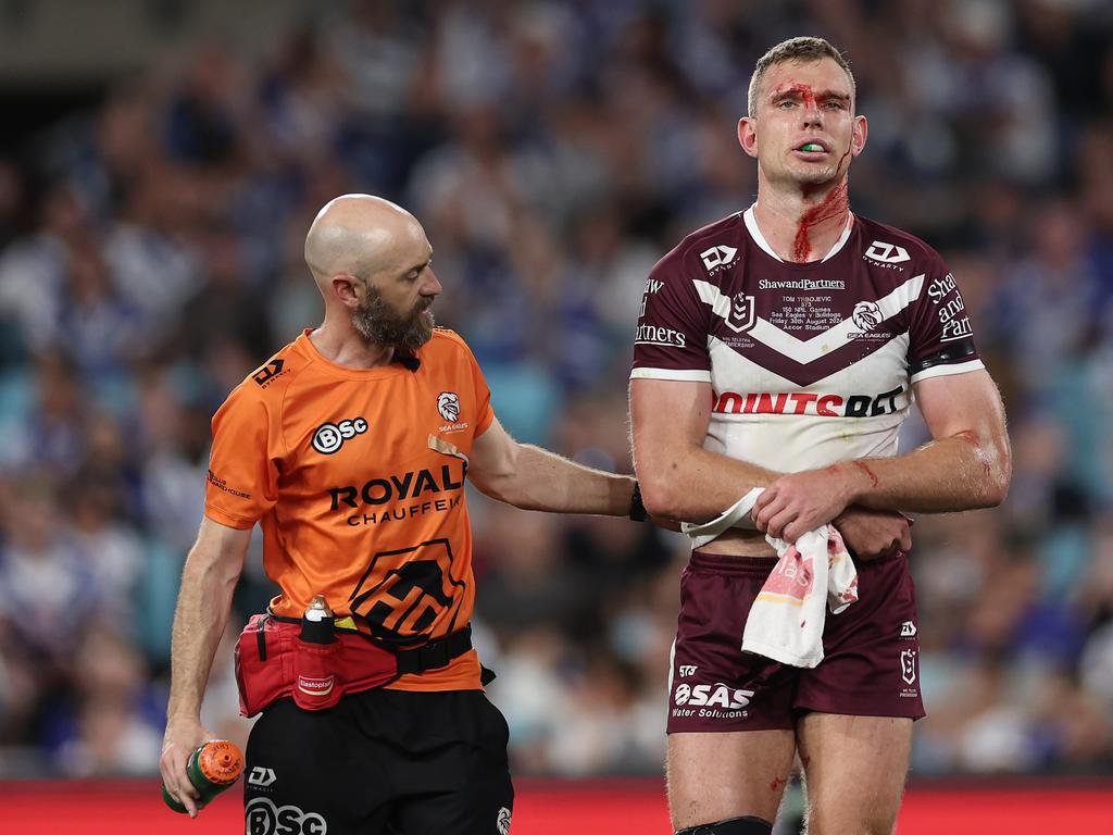 Tom Trbojevic still managed 20 games for the Sea Eagles in 2024 despite picking up numerous injuries. Picture: Getty Images