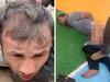 Terror suspect’s ‘genitals hooked to battery’
