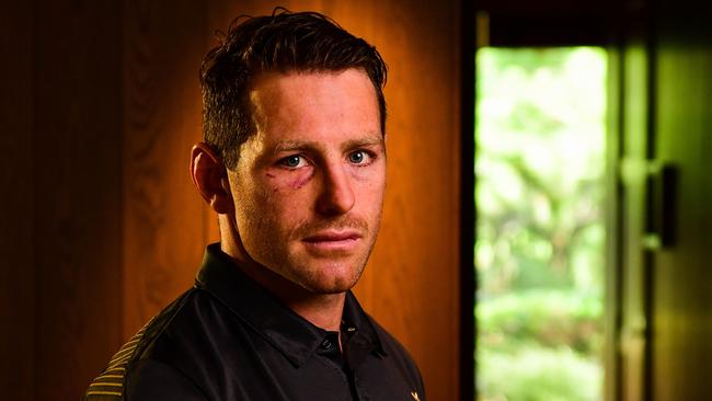 Wallaby Bernard Foley sporting his black eye in Tokyo. He will start against Wales. Picture: Stu Walmsley/Rugby Australia