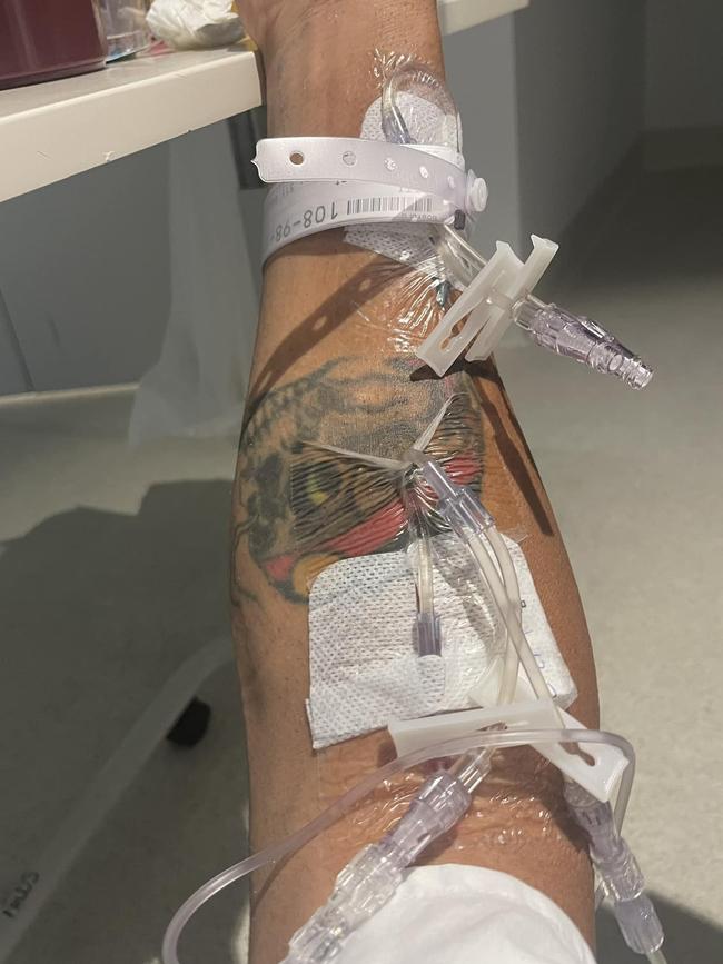 He posted photos of himself connected to multiple tubes. Picture: Facebook