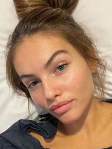 She recently revealed some health issues. Picture: Instagram/Thylane Blondeau