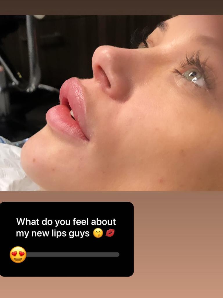 Jessika recently asked fans what they thought of her ‘new lips’. 