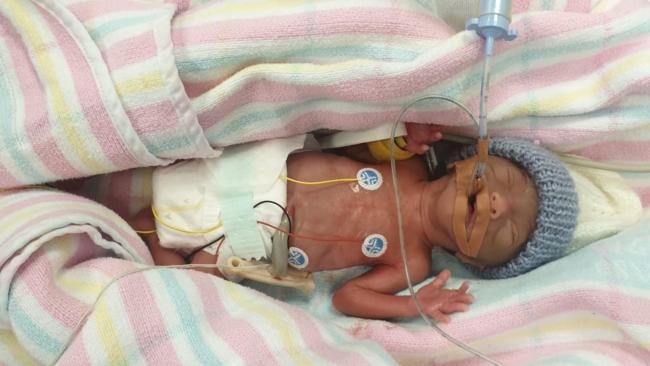 25 week old cheap premature baby