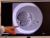 Aussies need more transparency on IVF success rates