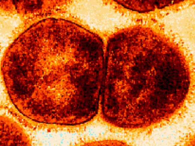 High magnification electron micrograph of an ultra-thin section of a group A streptococcus sibling pair. At this magnification, especially in the cell on the left, the cell wall and cell surface fibrils, consisting primarily of M protein, are well defined. Interdigitaion of these fibrils between neighboring cells of different chains is also in plain view. Strain: C126/21/1; M-type 43.  germ bacteria