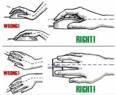 Typing is a key risk factor for the development of carpal tunnel syndrome. Have a look at these illustrations and the importance of hand position and prevent carpal tunnel from affecting you. Picture: Rowan Hunnam