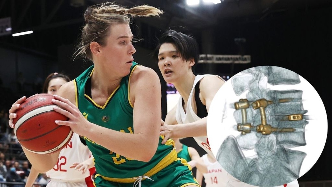 Life-changing surgery inspires Opals star after career of pain