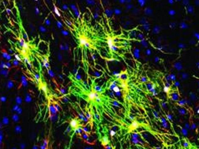 Under the microscope ... human brain cells in a mouse glow green after researchers tag them with a gene that looks green under fluorescent light. Picture: University of Rochester Medical Centre