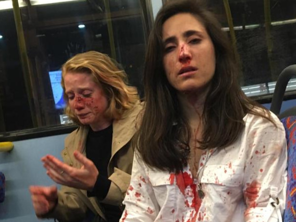 A battered and bloodied Melania Geymonat, 28, (right) and girlfriend Chris Hannigan sit shell-shocked on a night bus in north London in the aftermath of the attack. Picture: Facebook