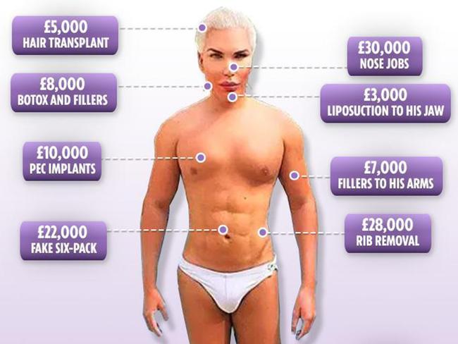 Human Ken doll: Harrowing history of cosmetic surgery addiction