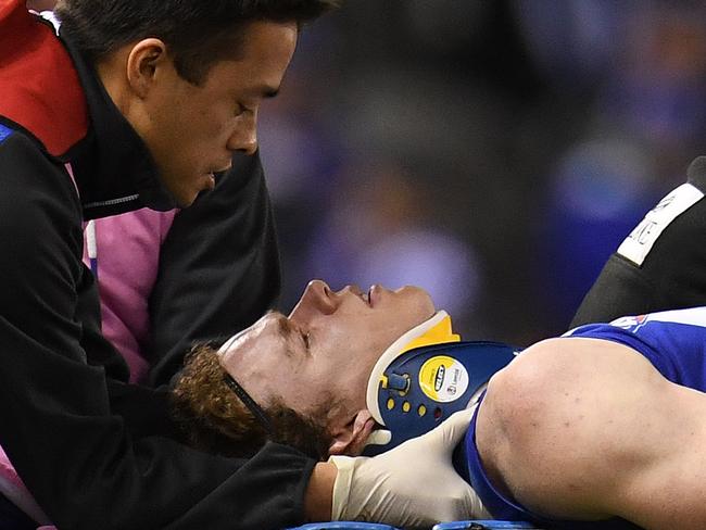 Ben Brown of the Kangaroos (right) is treated for concussion during the Round 20 AFL match between the North Melbourne Kangaroos and the Collingwood Magpies at the Etihad Stadium in Melbourne, Saturday, August 5, 2017. (AAP Image/Julian Smith) NO ARCHIVING, EDITORIAL USE ONLY