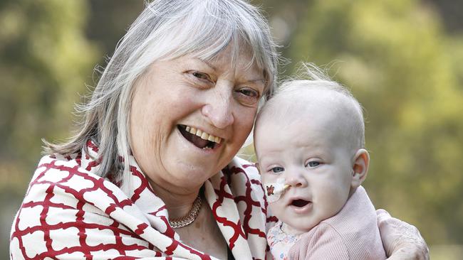 Christine Phillpot, 73, was a patient at the Royal Children’s Hospital in 1958, with baby Finley Sherwood, 7 months who is a current patient with a rare genetic condition. Picture: David Caird