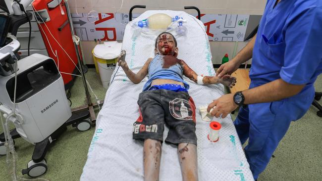 Medics tend to a Palestinian child injured during Israeli air strikes in a hospital in Khan Yunis in the southern of Gaza Strip. Picture: AFP.