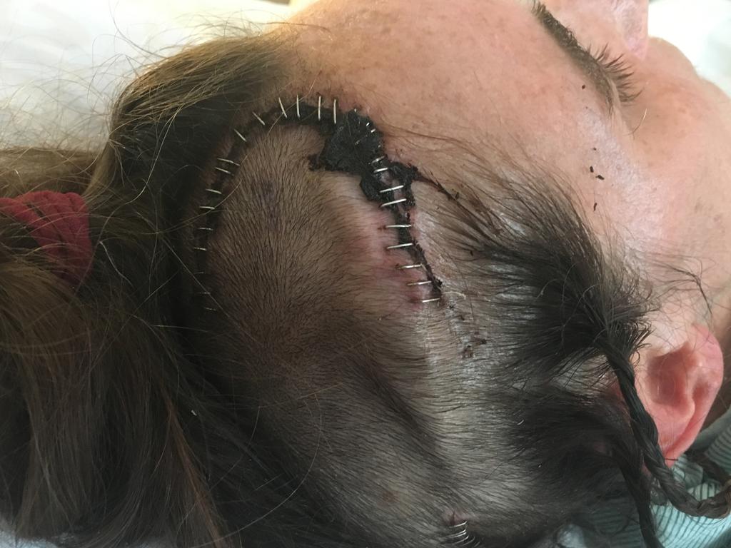 Mary Catherine had to undergo brain surgery after she was left paralysed and blind. Picture: Media Drum World / Australscope