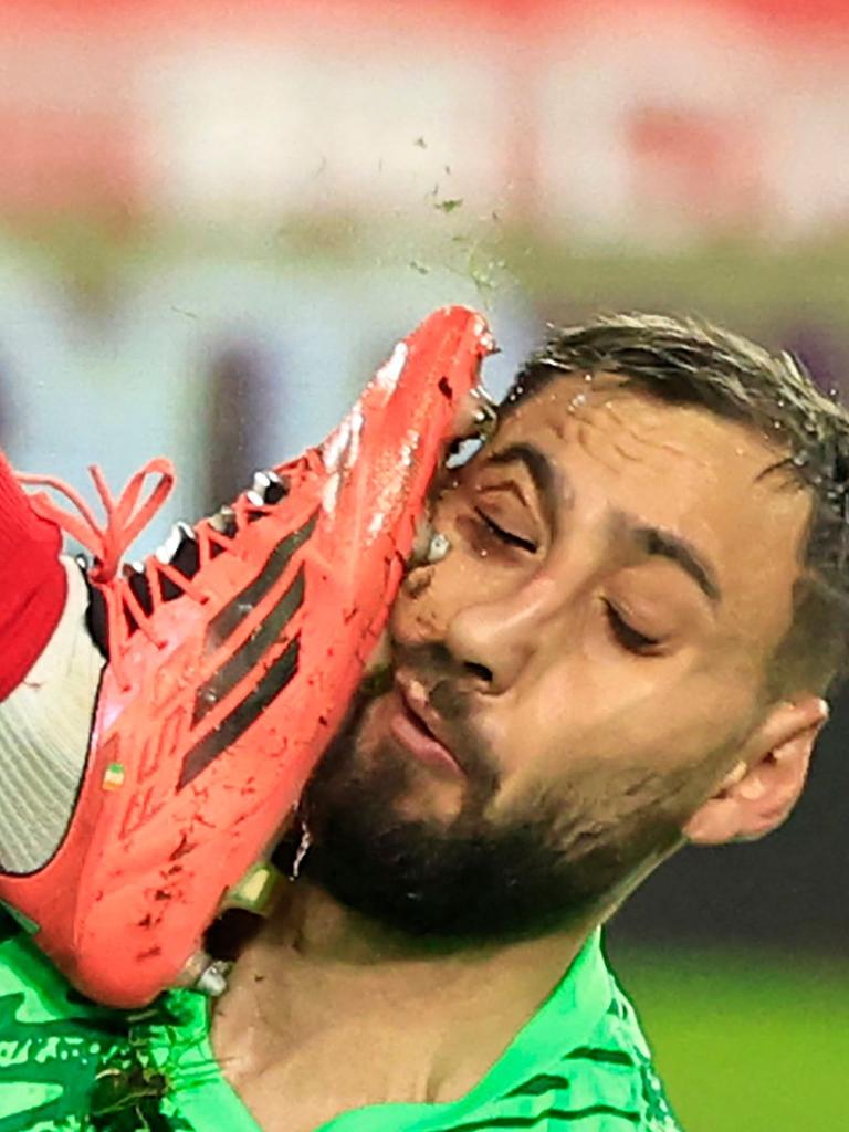 Donnarumma is lucky to have not lost an eye. (Photo by Valery HACHE / AFP)