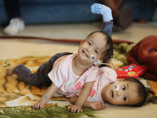 Nima and Dawa relax on the floor at the Children First Foundation Miracle Smiles Retreat in Kilmore before the operation. Picture: Alex Coppel