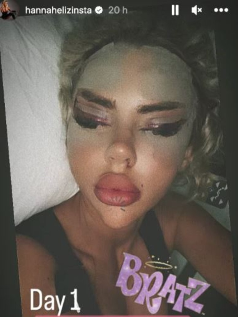 Reality star Hannah Elizabeth likened her surgically enhanced face to that of a Bratz doll. Picture: Instagram