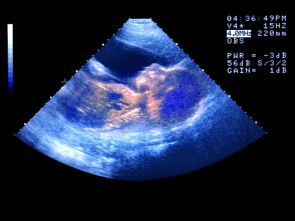 Health Minister Martin Foley told reporters that IVF clinics were being contacted by authorities and asked to cancel their appointments.