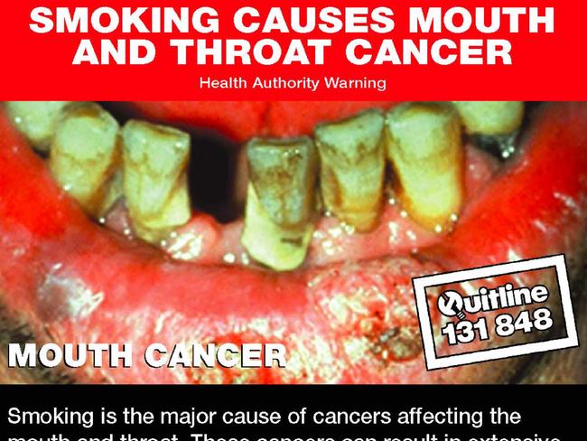 One of 14 graphic images showing the effects of smoking as part of an anti-smoking campaign.