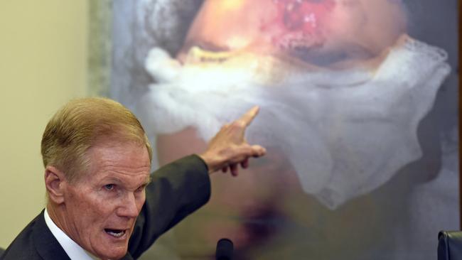 US Democrat Senator Bill Nelson shows a hearing the injury on a victim who was hit by shrapnel when a car's Takata airbag inflated. Picture: AP