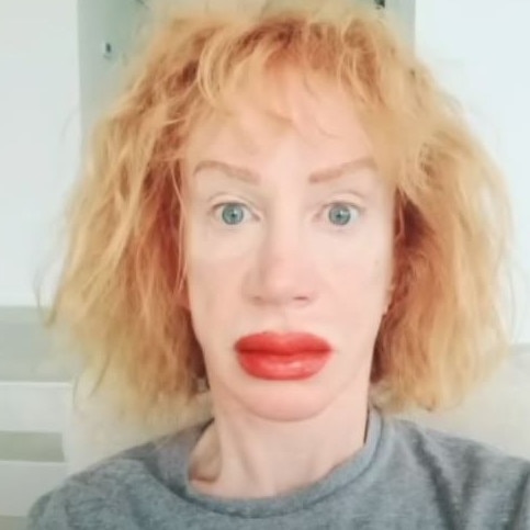 She was not expecting her lips to become this swollen.