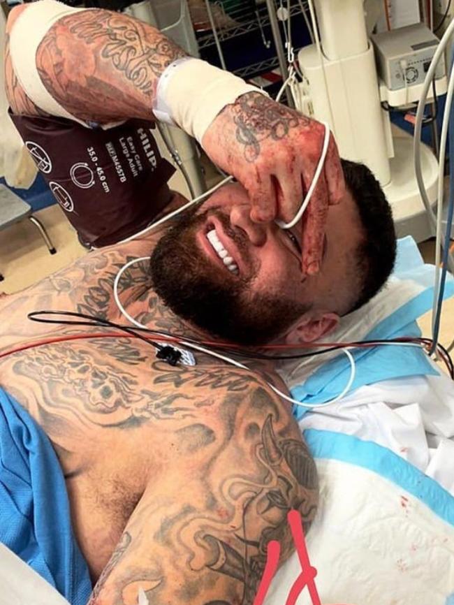 John Lavulo drove himself to Liverpool Hospital following the alleged shooting. Picture: Instagram