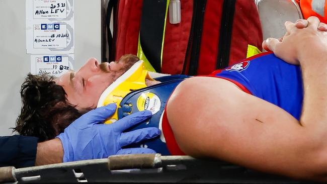 MELBOURNE, AUSTRALIA – SEPTEMBER 07: Angus Brayshaw of the Demons leaves the field on a stretcher during the 2023 AFL First Qualifying Final match between the Collingwood Magpies and the Melbourne Demons at Melbourne Cricket Ground on September 07, 2023 in Melbourne, Australia. (Photo by Dylan Burns/AFL Photos via Getty Images)