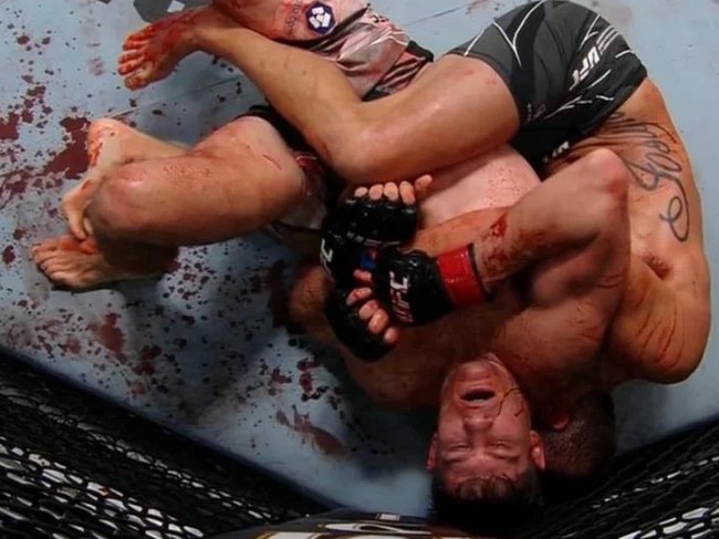 Horrifying ‘bloodbath’ injury rocks UFC