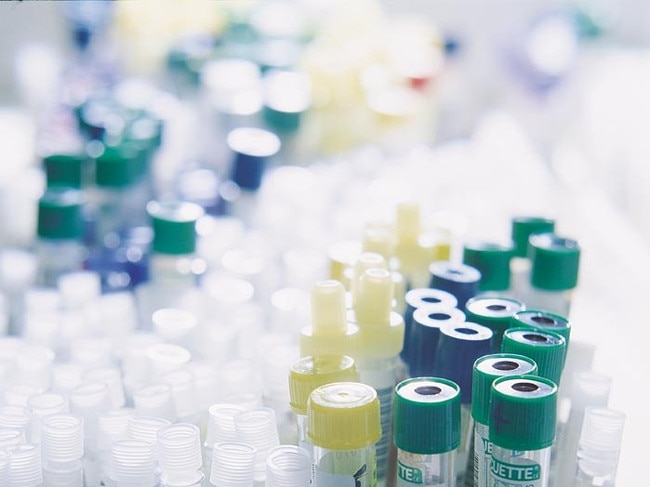 Generic photo of test tubes at Healthscope Pathology Laboratories.