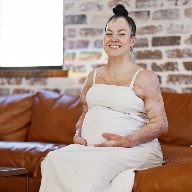 Sophie Delezio wants her baby and other children to learn “it’s normal and okay” to have and ask questions about disability, as she prepares to welcome her first – born this month. Picture: Sam Ruttyn