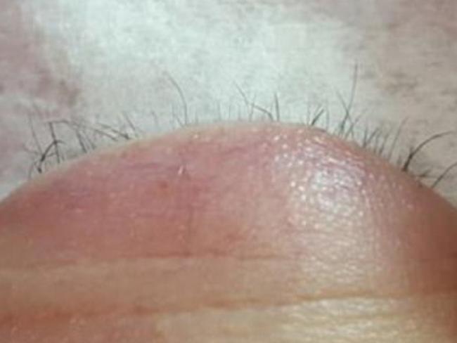 The customer’s eyelashes were falling out after the botched service. Picture: Facebook/Emmaculate Beauty