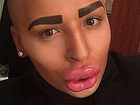 Man spends $190k to look like Kim Kardashian