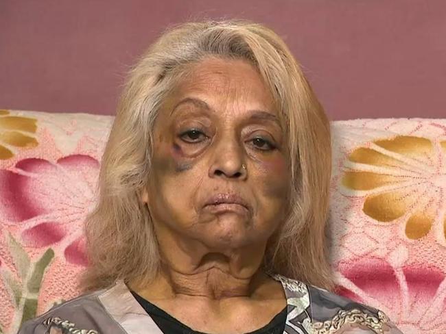 Ninette Simons, the victim of an assault and burglary in the Perth suburb of Girrawheen.