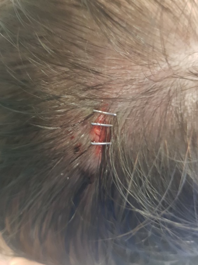 He is said to have needed three staples to his head. Picture: Supplied