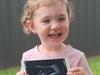 Toddler awaits brain surgery weeks before becoming a big sister