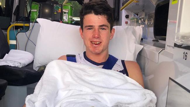 Andrew Brayshaw following the hit. Picture: Instagram