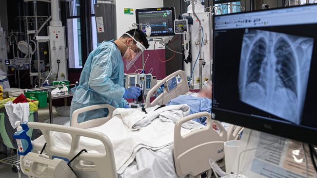 A patient is treated in the intensive care unit of Sunshine Hospital in Melbourne on Tuesday. Picture: Aaron Francis