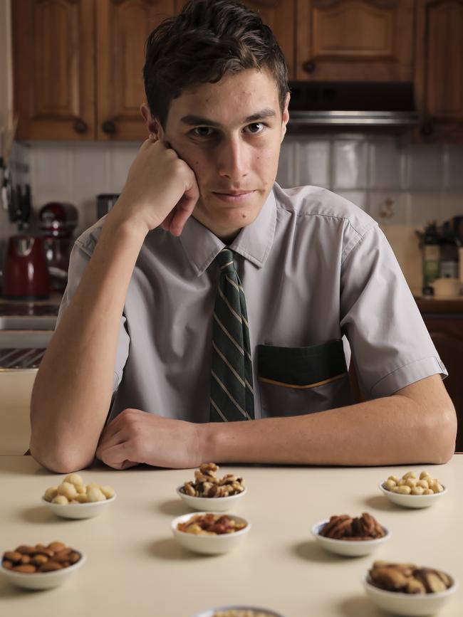 16-year-old Theodore Day has life-threatening allergies to pistachios and cashews and has developed debilitating anxiety as a result. Photo: Mark Cranitch.