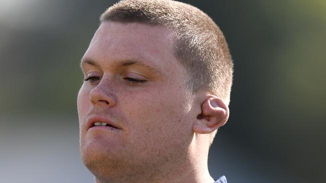 Tom Robertson of the Waratahs boasts a classic cauliflower ear.